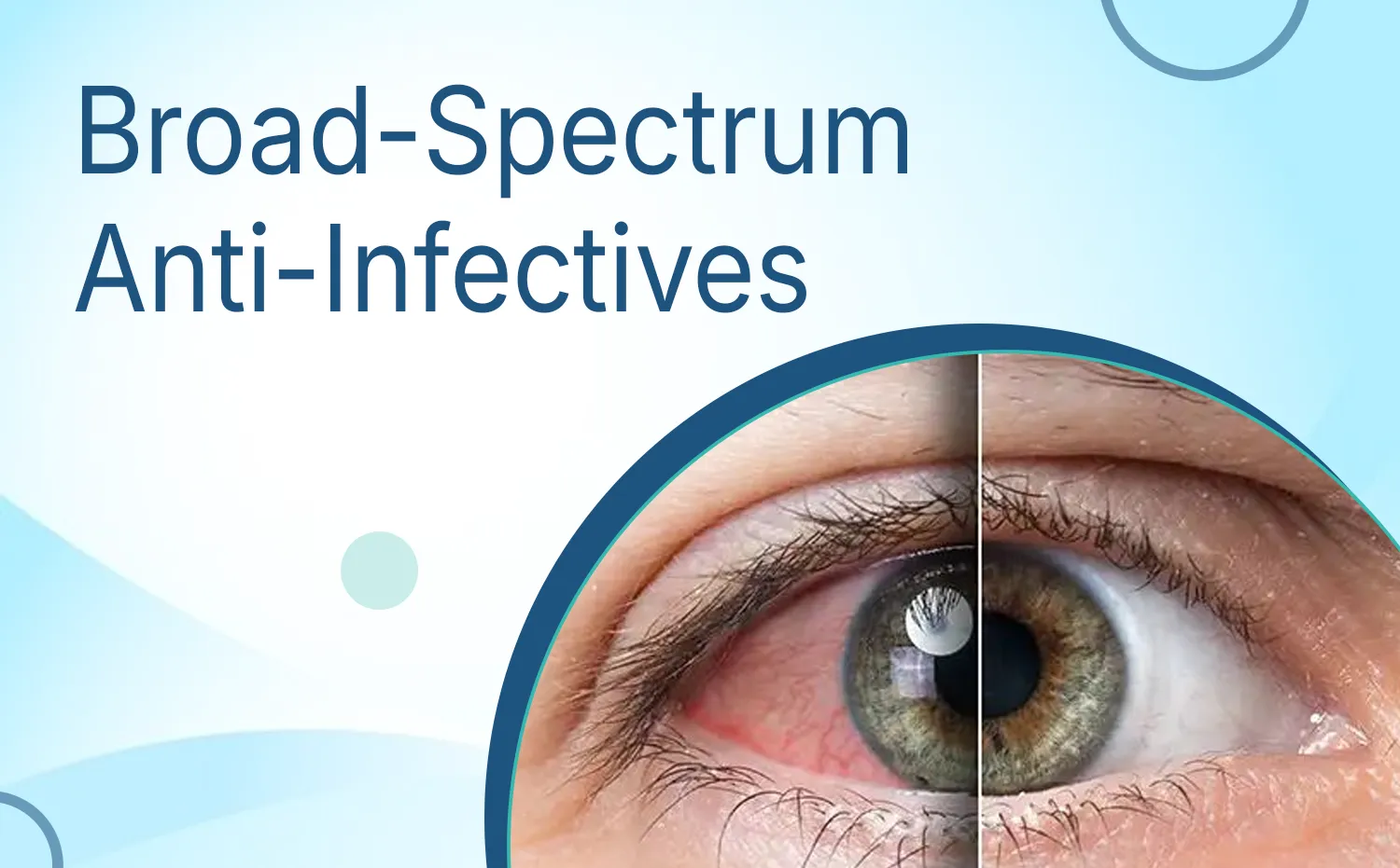 Broad-Spectrum Anti-Infectives