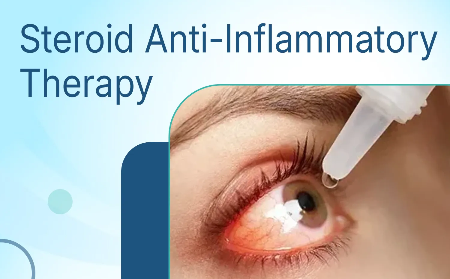 Steroid Anti-Inflammatory Therapy