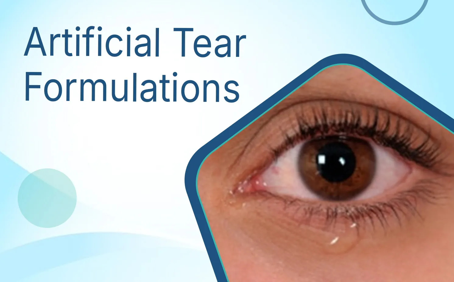 Artificial Tear Formulations