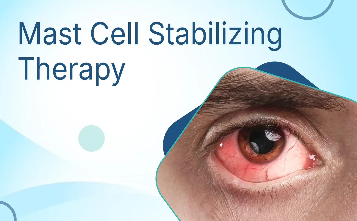 Mast Cell Stabilizing Therapy (2)