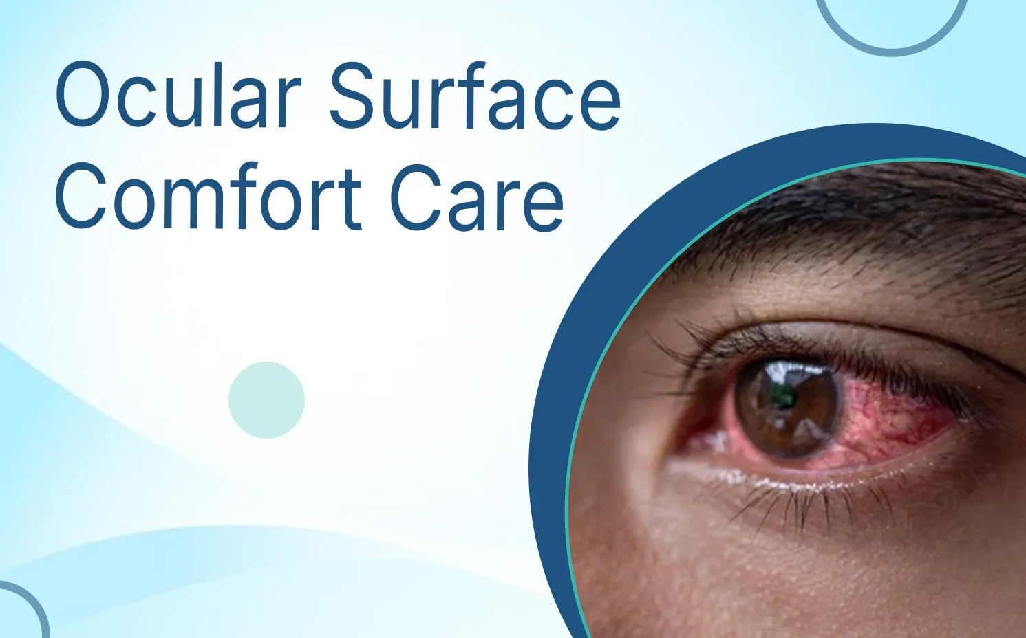 Ocular Surface Comfort Care