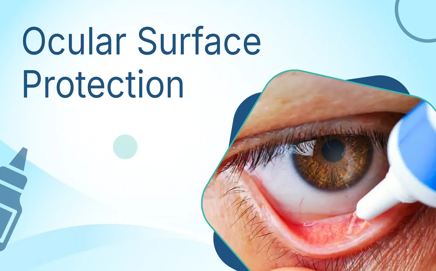 Ocular Surface Protection