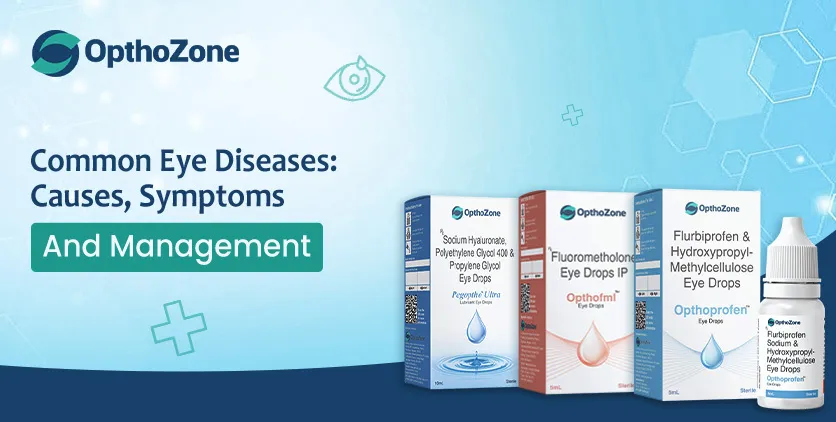 Common Eye Diseases Causes, Symptoms, and Management
